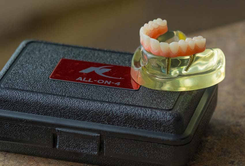 All-4-one dentures display case sitting on a table