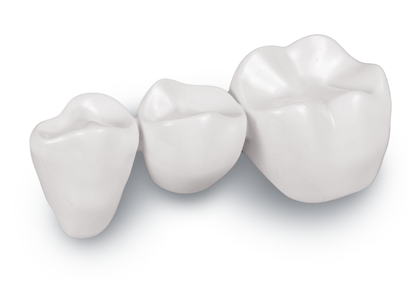 Close up of a dental bridge on a table