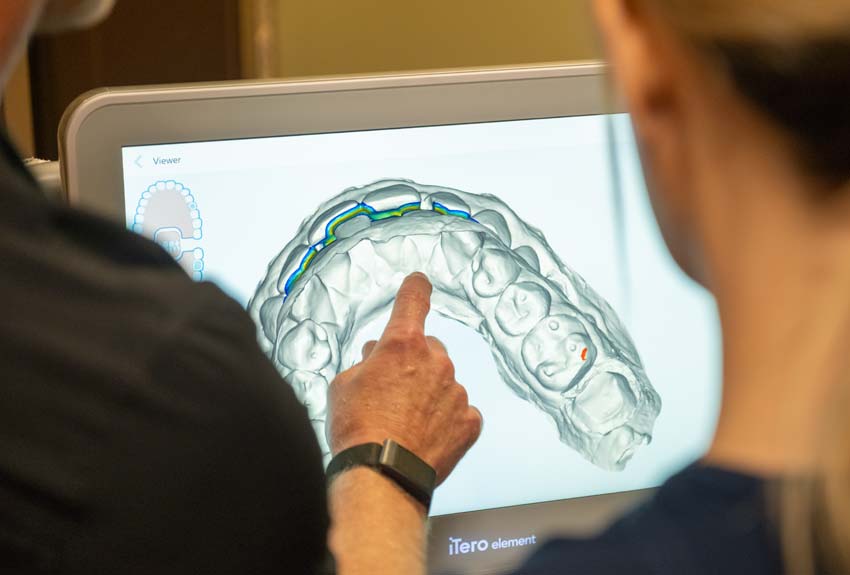 Dr. Harper and hygenist looking at a computer screen showing a 3-D model of teeth